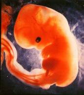 Зародыш (ребёнок) 6 недель