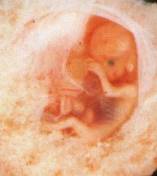 Зародыш (ребёнок) 9 недель