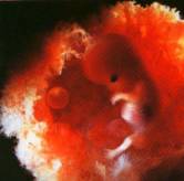 Зародыш (ребёнок) 10 недель