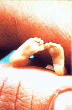Зародыш (ребёнок) 11 недель - ножки